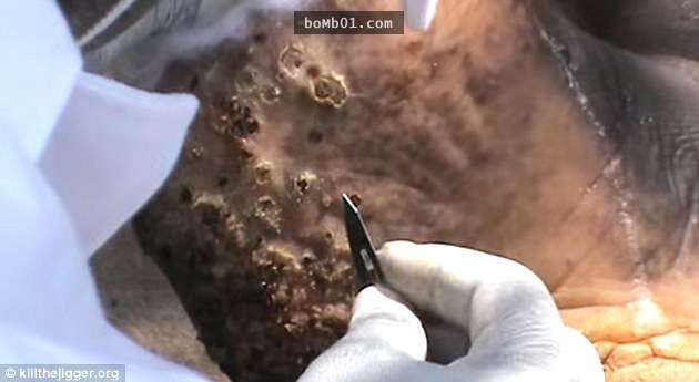 Can You Catch Stomach Bugs From Dogs Can You Catch Stomach Bugs From Dogs