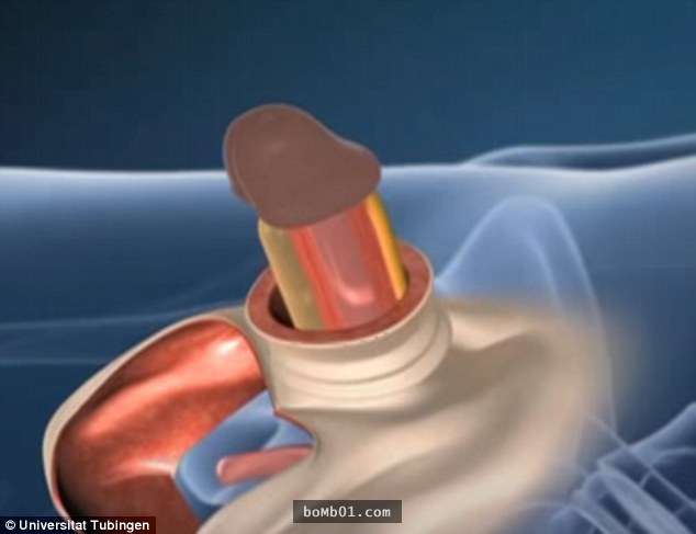 anal vibration during ejaculation heavy mucous from anus