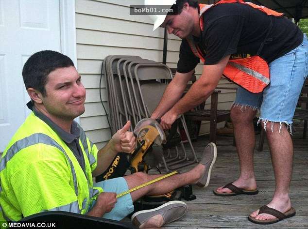 这个男子知道左腿即将被截掉后,他的反应竟然是为自己的左腿拍下一