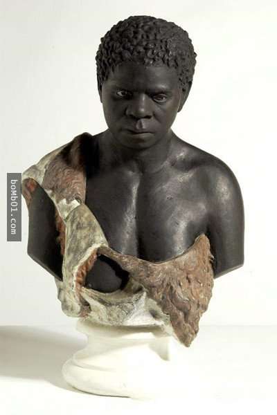 这个珍稀的女人求大家「死后不要解剖我,不要展览我