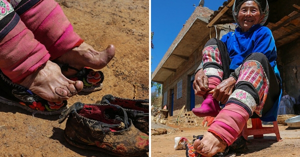 这位老奶奶是全中国「最后一位缠足妇女」,过去踩成「血肉模糊的脚掌